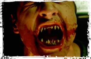 Donovan Teen Wolf Terminal Condition